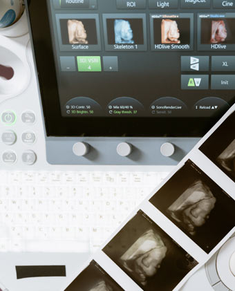 für 3D/4D-Ultraschall in Echtzeit für 3D/4D-Ultraschall in Echtzeit